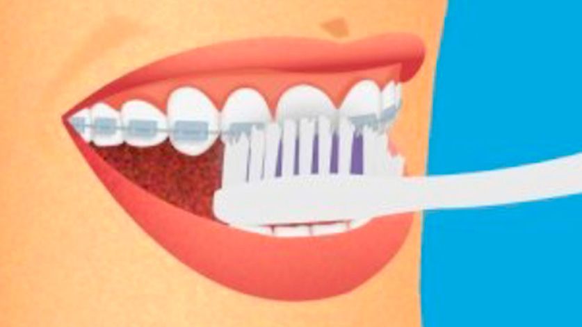 Illustration qui met en scène l'action de se brosser les dents.