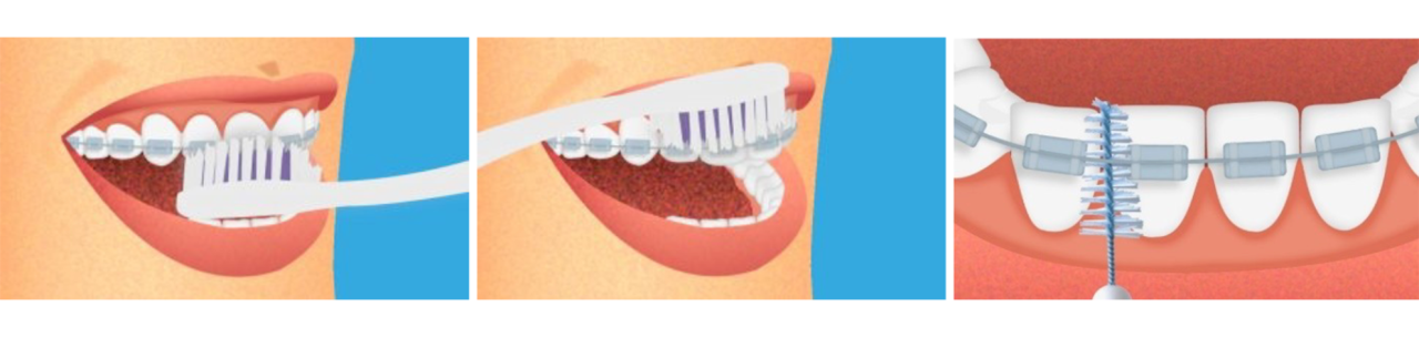 Juxtaposition de trois visuels qui donnent les bons conseils de brossage, afin que ce dernier soit efficace.