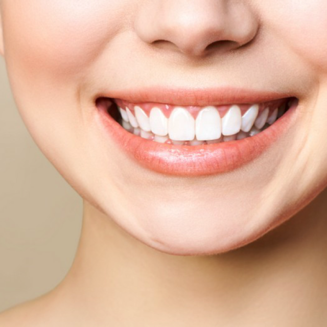 Photographie d'une femme qui sourit et qui montre ses dents bien alignées.